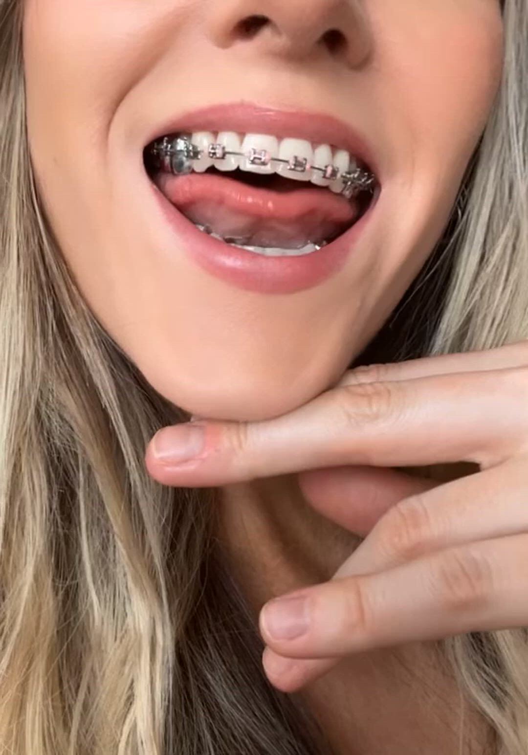 Braces porn video with onlyfans model andiexsocial <strong>@andie_x</strong>